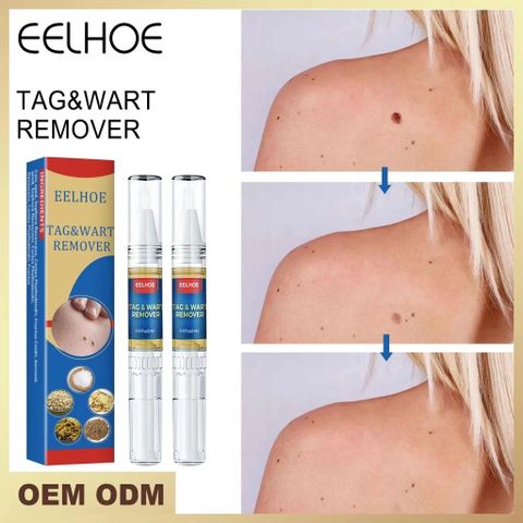 Kem Tẩy Nốt Ruồi & Mụn Cóc - Giải Pháp Làm Sạch Da Hiệu Quả, Dễ Sử Dụng, Chăm Sóc Da Toàn Diện