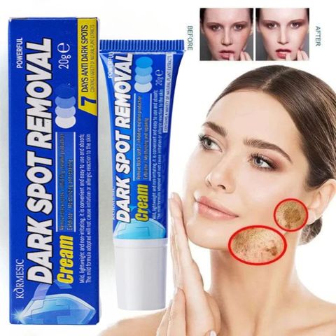 Kem Nám Tàn Nhang Dưỡng Trắng Da Mặt USA 20g - Giúp Làm Mờ Đốm Nâu, Nám và Tàn Nhang, Da Trắng Sáng Tự Nhiên