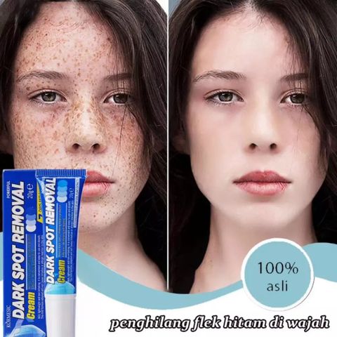 Kem Nám Tàn Nhang Dưỡng Trắng Da Mặt USA 20g - Giúp Làm Mờ Đốm Nâu, Nám và Tàn Nhang, Da Trắng Sáng Tự Nhiên