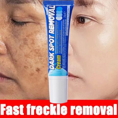 Kem Nám Tàn Nhang Dưỡng Trắng Da Mặt USA 20g - Giúp Làm Mờ Đốm Nâu, Nám và Tàn Nhang, Da Trắng Sáng Tự Nhiên