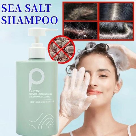Dầu Gội Sạch Gàu – Phục Hồi Nang Tóc, Ngăn Ngừa Rụng Tóc, Làm Sạch Da Đầu Nhờn, Giảm Ngứa Da Đầu, Dầu Gội Chất Lượng Cao