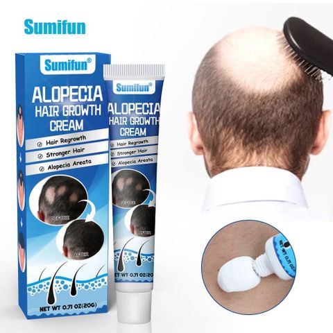 Kem Mọc Tóc Alopecia Hair Growth Cream - Kích Thích Mọc Tóc, Giảm Gãy Rụng, Nuôi Dưỡng Tóc Chắc Khỏe 20g