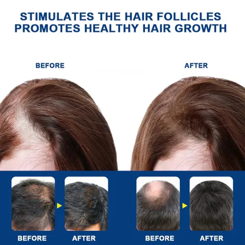 Kem Mọc Tóc Alopecia Hair Growth Cream - Kích Thích Mọc Tóc, Giảm Gãy Rụng, Nuôi Dưỡng Tóc Chắc Khỏe 20g