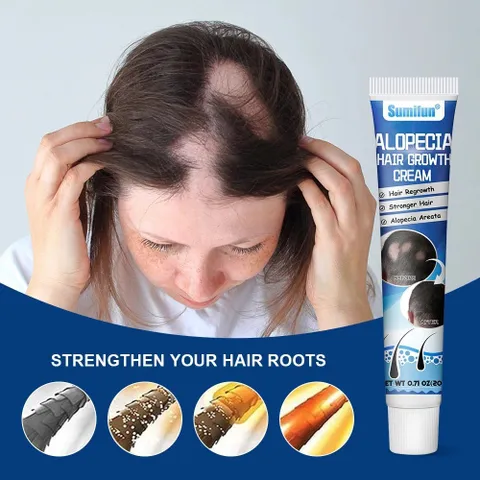 Kem Mọc Tóc Alopecia Hair Growth Cream - Kích Thích Mọc Tóc, Giảm Gãy Rụng, Nuôi Dưỡng Tóc Chắc Khỏe 20g