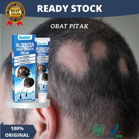 Kem Mọc Tóc Alopecia Hair Growth Cream - Kích Thích Mọc Tóc, Giảm Gãy Rụng, Nuôi Dưỡng Tóc Chắc Khỏe 20g