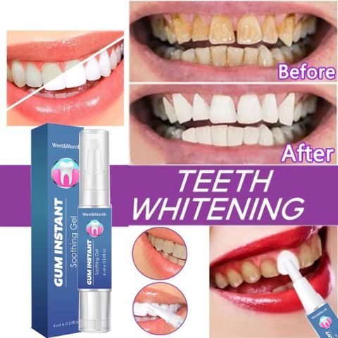 Bút Tẩy Trắng Răng Nha Khoa TEETH Whitening Pen - Giúp Làm Sạch Mảng Bám, Răng Trắng Sáng Tự Nhiên, Tiện Lợi và An Toàn
