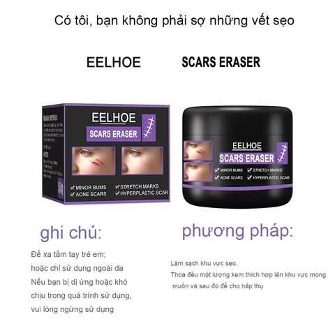 Kem Xóa Sẹo EELHOE - Giải Pháp Hiệu Quả Xóa Sẹo Lâu Năm, Phẫu Thuật và Rạn Da Sau Mang Thai