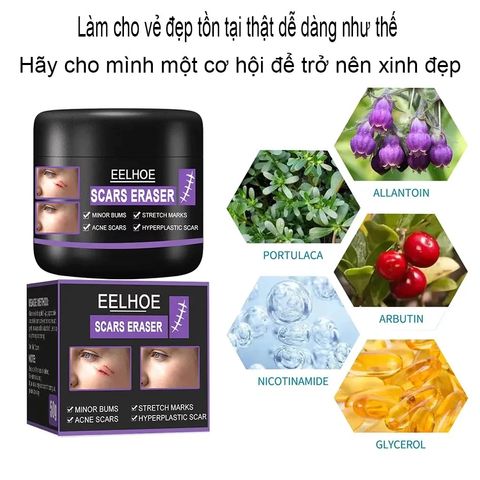 Kem Xóa Sẹo EELHOE - Giải Pháp Hiệu Quả Xóa Sẹo Lâu Năm, Phẫu Thuật và Rạn Da Sau Mang Thai