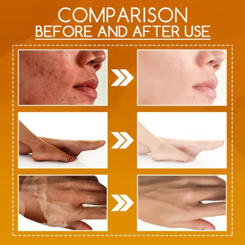 Kem Tẩy Da Chết Peel Da Mặt Vi 100g - Tái Tạo Da, Làm Trắng Da, Giảm Thâm Nám, Chăm Sóc Da Toàn Diện
