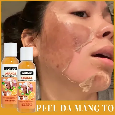 Kem Tẩy Da Chết Peel Da Mặt Vi 100g - Tái Tạo Da, Làm Trắng Da, Giảm Thâm Nám, Chăm Sóc Da Toàn Diện