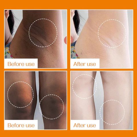 Kem Làm Trắng Nách Hàn Quốc Vitamin C 60g - Cải Thiện Da Sáng Mịn, Mờ Vết Thâm, Chăm Sóc Da Toàn Thân