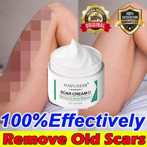 Kem Mờ Sẹo 50g - Giúp Làm Mờ Sẹo Thâm, Sẹo Mụn, Nuôi Dưỡng Da Mềm Mại - Sản Phẩm Chất Lượng Từ Thụy Sĩ