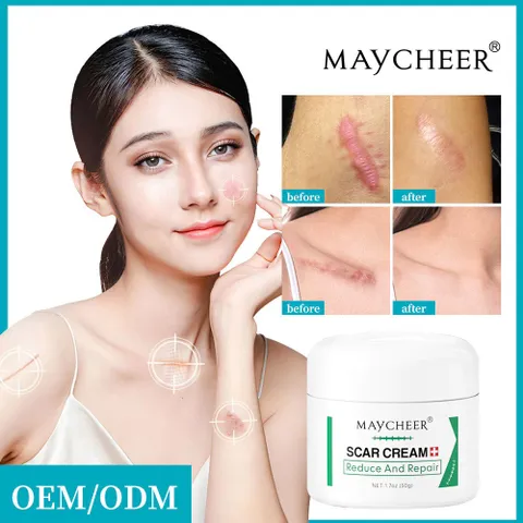 Kem Mờ Sẹo 50g - Giúp Làm Mờ Sẹo Thâm, Sẹo Mụn, Nuôi Dưỡng Da Mềm Mại - Sản Phẩm Chất Lượng Từ Thụy Sĩ