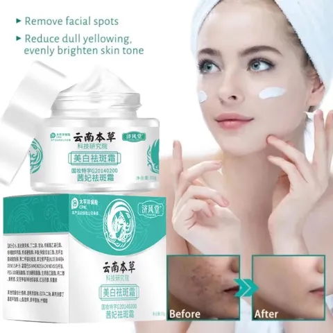 Kem Xóa Nám Tàn Nhang 30g - Tinh Chất Làm Trắng Da Mặt Hiệu Quả, Dưỡng Ẩm & Làm Sáng Đều Màu Da
