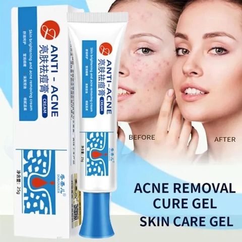 Gel Loại Bỏ Mụn - Kem Giảm Mụn Nhanh 25g, Hỗ Trợ Mờ Vết Thâm, Kiểm Soát Dầu, Phục Hồi Da, Sản Phẩm Chăm Sóc Da Chất Lượng