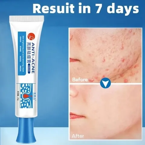 Gel Loại Bỏ Mụn - Kem Giảm Mụn Nhanh 25g, Hỗ Trợ Mờ Vết Thâm, Kiểm Soát Dầu, Phục Hồi Da, Sản Phẩm Chăm Sóc Da Chất Lượng