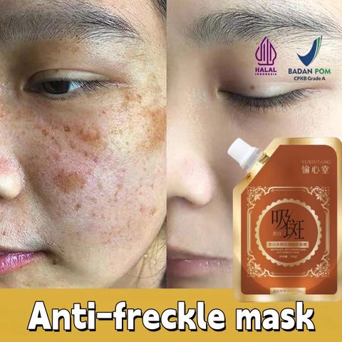 Mặt Nạ Lột Mụn Đầu Đen & Thâm Nám - Giải Pháp Làm Sạch Da, Se Khít Lỗ Chân Lông, Và Ngăn Ngừa Dầu Thừa, 100g
