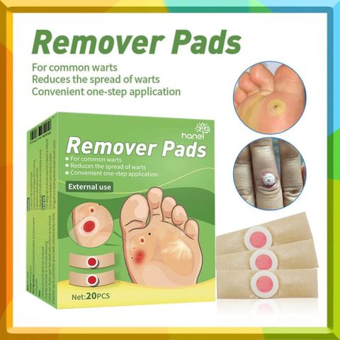 Gói 30 Miếng Dán Loại Bỏ Mụn Cóc - Gel Chăm Sóc Chân Ngón, Độ Mạnh Tối Đa, Giải Pháp Hiệu Quả Không Đau Đớn
