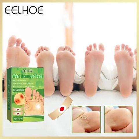 Gói 30 Miếng Dán Loại Bỏ Mụn Cóc - Gel Chăm Sóc Chân Ngón, Độ Mạnh Tối Đa, Giải Pháp Hiệu Quả Không Đau Đớn