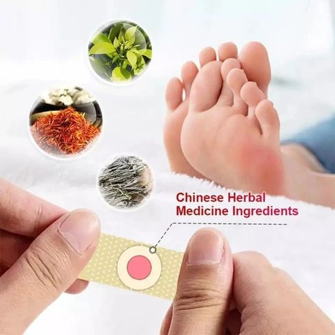 Gói 30 Miếng Dán Loại Bỏ Mụn Cóc - Gel Chăm Sóc Chân Ngón, Độ Mạnh Tối Đa, Giải Pháp Hiệu Quả Không Đau Đớn