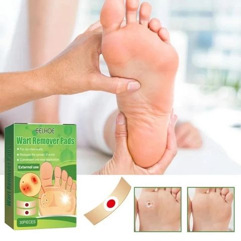 Gói 30 Miếng Dán Loại Bỏ Mụn Cóc - Gel Chăm Sóc Chân Ngón, Độ Mạnh Tối Đa, Giải Pháp Hiệu Quả Không Đau Đớn