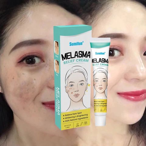 Kem Trị Nám Tàn Nhang SUMIFUN 20g - Làm Sáng Da, Mờ Đốm Đen, Phù Hợp Mọi Loại Da, Giải Pháp Chăm Sóc Da An Toàn