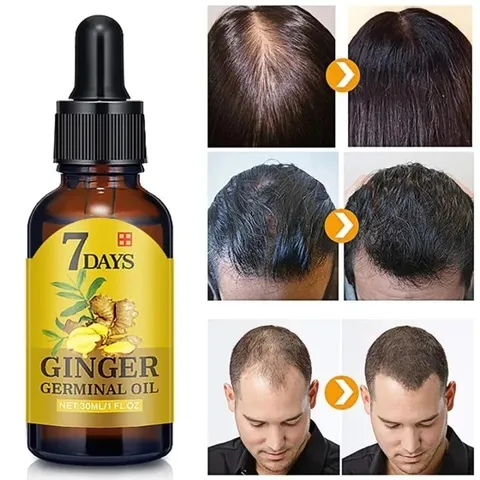 Tinh Chất Gừng Tươi Dưỡng Tóc - Hỗ Trợ Kích Thích Mọc Tóc, Tóc Khỏe Mạnh Sau 7 Ngày - Giải Pháp Cho Tóc Hư Tổn