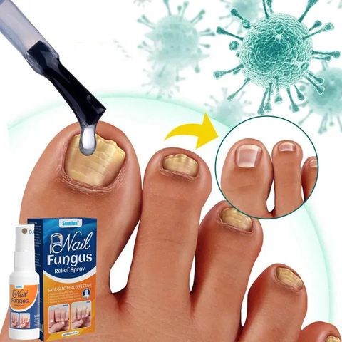 Bình Xịt Giảm Nấm Móng - Chăm Sóc Tay Chân Gia Truyền, Hỗ Trợ Khắc Phục Hư Khoé, Bọng Móng, Dễ Sử Dụng, Hiệu Quả Nhanh Chóng