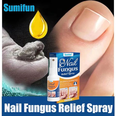 Bình Xịt Giảm Nấm Móng - Chăm Sóc Tay Chân Gia Truyền, Hỗ Trợ Khắc Phục Hư Khoé, Bọng Móng, Dễ Sử Dụng, Hiệu Quả Nhanh Chóng