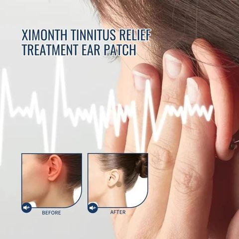 Miếng Dán Chống Say Tàu Xe Cho Trẻ Em & Người Lớn - 10 Miếng Thảoo Dượcc Tự Nhiên, Giảm Cảm Giác Say Xe, An Toàn Tuyệt Đối