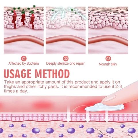 Kem Bôi Phụ Khoa Đa Năng 20g - Giảm Ngứa, Làm Sạch, Dưỡng Ẩm & Cân Bằng Độ pH Vùng Kín Cho Nữ