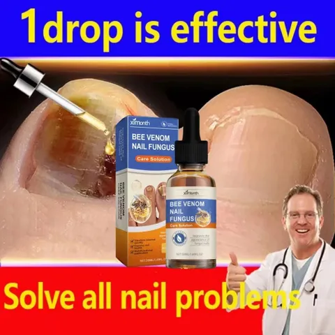 Tinh Chất Loại Bỏ Nấm Móng 50ML - Kem Phục Hồi Móng Tay, Chân Kháng Khuẩn, Chăm Sóc Móng Yếu, Hỗ Trợ Khôi Phục Sức Khỏe Móng