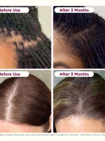 Viên Uống Biotin Hỗ Trợ Tóc Dày Mượt - Nature's Bounty 90 Viên Giúp Tăng Trưởng Tóc Khỏe Mạnh, Không Chứa Gelatin, Dành Cho Người Ăn Chay
