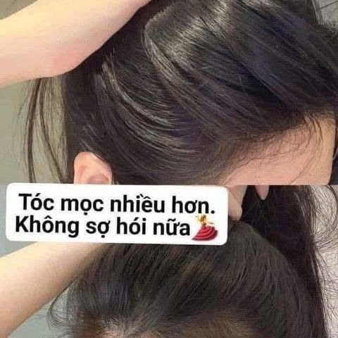 VIÊN UỐNG BEAUTY HAIR SKIN NAILS NATURE'S BOUNTY 250 Viên - Hỗ Trợ Cải Thiện Da, Tóc, Móng Khỏe Đẹp Từ Mỹ