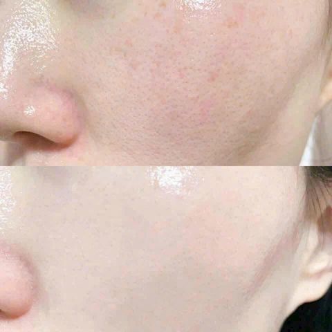 Tinh Chất Vàng 24K Ohui The First Geniture Ampoule Advanced 20ml - Serum Chống Lão Hóa, Phục Hồi Da Săn Chắc, Sáng Mịn