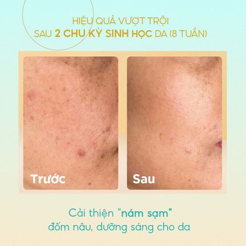 Tinh Chất Dưỡng Trắng Cấp Ẩm GUO Radiance 4X Ampoule 30ml - Serum Làm Mờ Thâm Sạm Dành Cho Bà Bầu, An Toàn Và Hiệu Quả