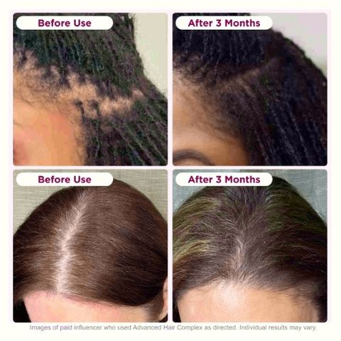 Viên Uống Biotin Hỗ Trợ Tóc - Nature's Bounty Hair Growth 90 Viên - Tăng cường sức khỏe tóc, ngăn rụng tóc hiệu quả