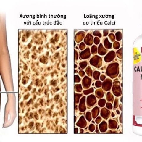 Viên uống bổ sung canxi Kirkland Calcium Citrate 500 viên - Hỗ trợ xương chắc khỏe với Vitamin D, Magie và Kẽm - Hàng chính hãng Mỹ