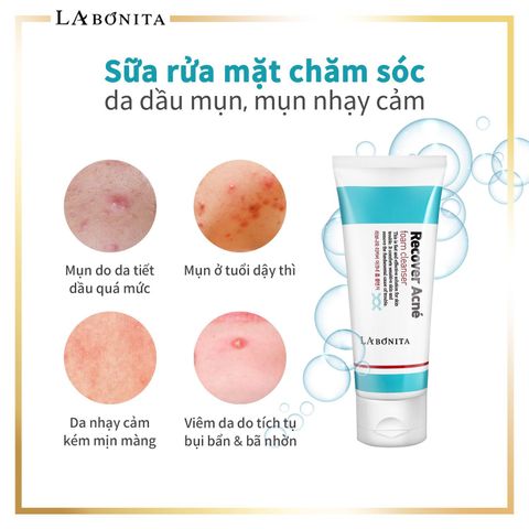 Sữa Rửa Mặt LaBonita 100ml Cho Da Dầu Mụn - Làm Sạch Hiệu Quả, Giảm Mụn, Dưỡng Ẩm Tự Nhiên, Phù Hợp Với Da Nhờn