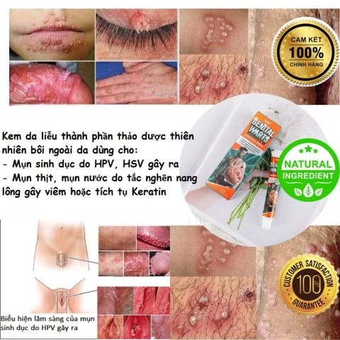 Kem Bôi Giảm Ngứa Vùng Kín SUMIFUN - Tinh Chất Thảo Mộc Hỗ Trợ Chăm Sóc Nấm, Mụn Sinh Dục, Sùi Mào Gà, 50g