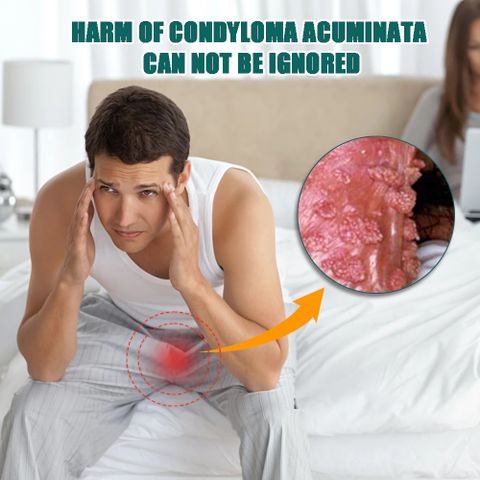Kem Bôi Giảm Ngứa Vùng Kín SUMIFUN - Tinh Chất Thảo Mộc Hỗ Trợ Chăm Sóc Nấm, Mụn Sinh Dục, Sùi Mào Gà, 50g