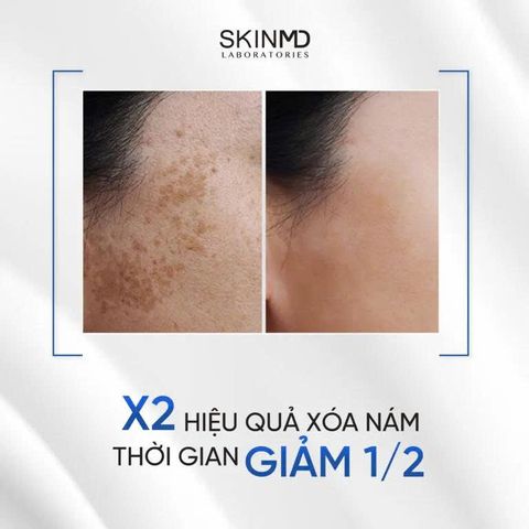 Serum SkinMD Pure Whitenol - Giảm Thâm, Mờ Nám, Làm Trắng Da An Toàn và Hiệu Quả cho Da Nhạy Cảm