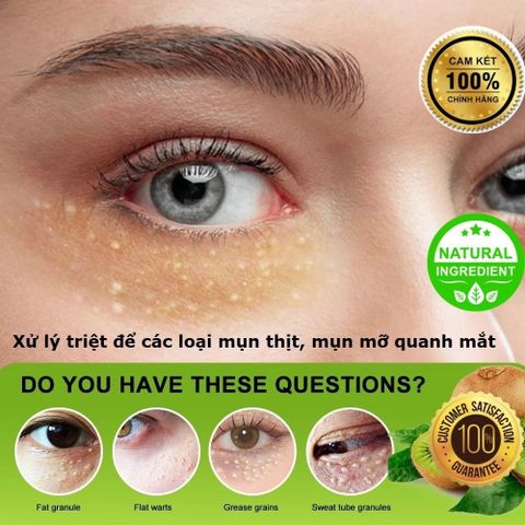 Kem Tẩy Mụn Thịt Quanh Mắt SUMIFUN - Giảm Thâm và Dưỡng Da Mắt với Vitamin E, Hỗ Trợ Làm Mịn Vùng Da Nhạy Cảm