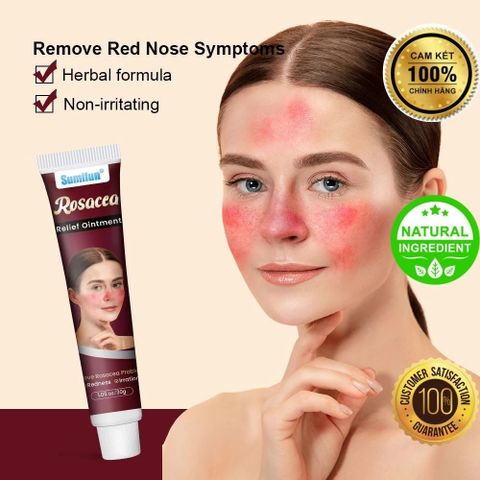 Kem Bôi Mũi Đỏ Rosacca - Giải Pháp Thảo Mộc 100% Cho Da Nhạy Cảm, Dị Ứng, Viêm Da Mặt, Hỗ Trợ Làm Dịu, Phục Hồi Da Tổn Thương