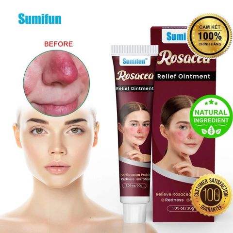 Kem Bôi Mũi Đỏ Rosacca - Giải Pháp Thảo Mộc 100% Cho Da Nhạy Cảm, Dị Ứng, Viêm Da Mặt, Hỗ Trợ Làm Dịu, Phục Hồi Da Tổn Thương