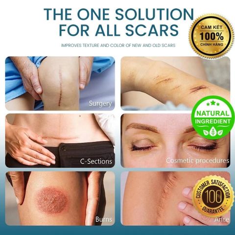 Gel Bôi Sẹo Mụn, Sẹo Thâm & Sẹo Bỏng SUMIFUN - Giải Pháp Nhanh Chóng Khôi Phục Da Tự Nhiên, Không Đau Rát