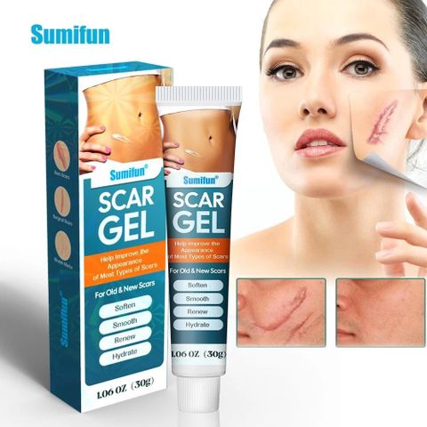 Gel Bôi Sẹo Mụn, Sẹo Thâm & Sẹo Bỏng SUMIFUN - Giải Pháp Nhanh Chóng Khôi Phục Da Tự Nhiên, Không Đau Rát