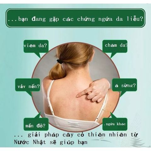 Kem Bôi Nấm Ngứa Nhật Bản - Giảm Ngứa Da, Chàm, Nấm, Vảy Nến, Dị Ứng - Thảo Dược Tự Nhiên, An Toàn Cho Da Nhạy Cảm