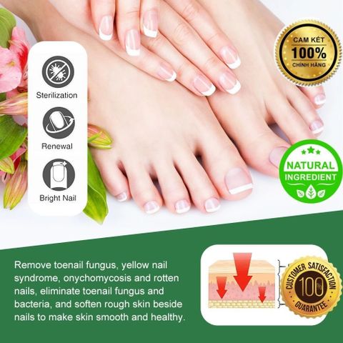 Kem Bôi Nấm Móng Thối Móng SUMIFUN – Chiết Xuất Thiên Nhiên An Toàn, Hỗ Trợ Khắc Phục Móng Yếu, Nấm Móng, Thối Móng