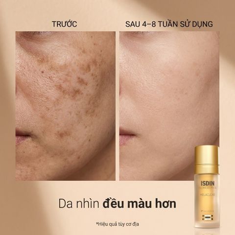 Tinh Chất Mờ Thâm Nám ISDIN Melaclear Advanced 30ml - Làm Sáng, Đều Màu Da, Ngừa Nám, Dưỡng Ẩm Da Mịn Màng